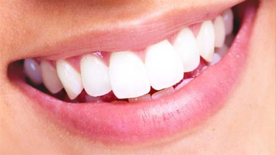 Blanquear dientes con bicarbonato, ¿es bueno o malo?