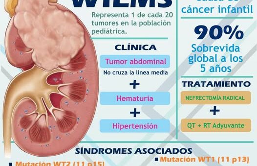 Tumor de Wilms: causas, síntomas y tratamiento
